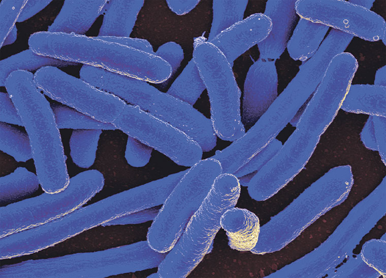 Micrografía coloreada de E. coli | NIAID / CC BY 2.0